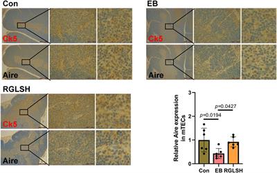 Protective effects of Ganoderma lucidum spores on estradiol benzoate-induced TEC apoptosis and compromised double-positive thymocyte development